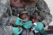 File photo of Afghan child injured during military fighting