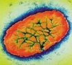 Bordetella pertussis