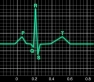 Electrocardiogram