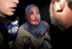 Scene in Gaza during the Israeli attacks