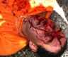 Imad Rizka critically injured during the weekly Bil’in protest on Friday – photo by Hamdi Abu Rahmah www.bilin-ffj.org