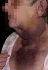 73-year old woman who was assaulted in Clackamas, Ore. 1-24-09