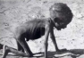 Baby dying of polio
