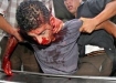 Death by uranium in Gaza