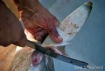 Shark fin industry