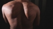 Scars of torture in Sri Lanka