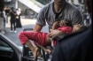 injured child in Gaza