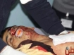 The body of 16-year old Samir Ahmed Awad