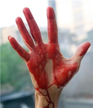 The bloody hand of a protester underscores the commitment of the Persian people.